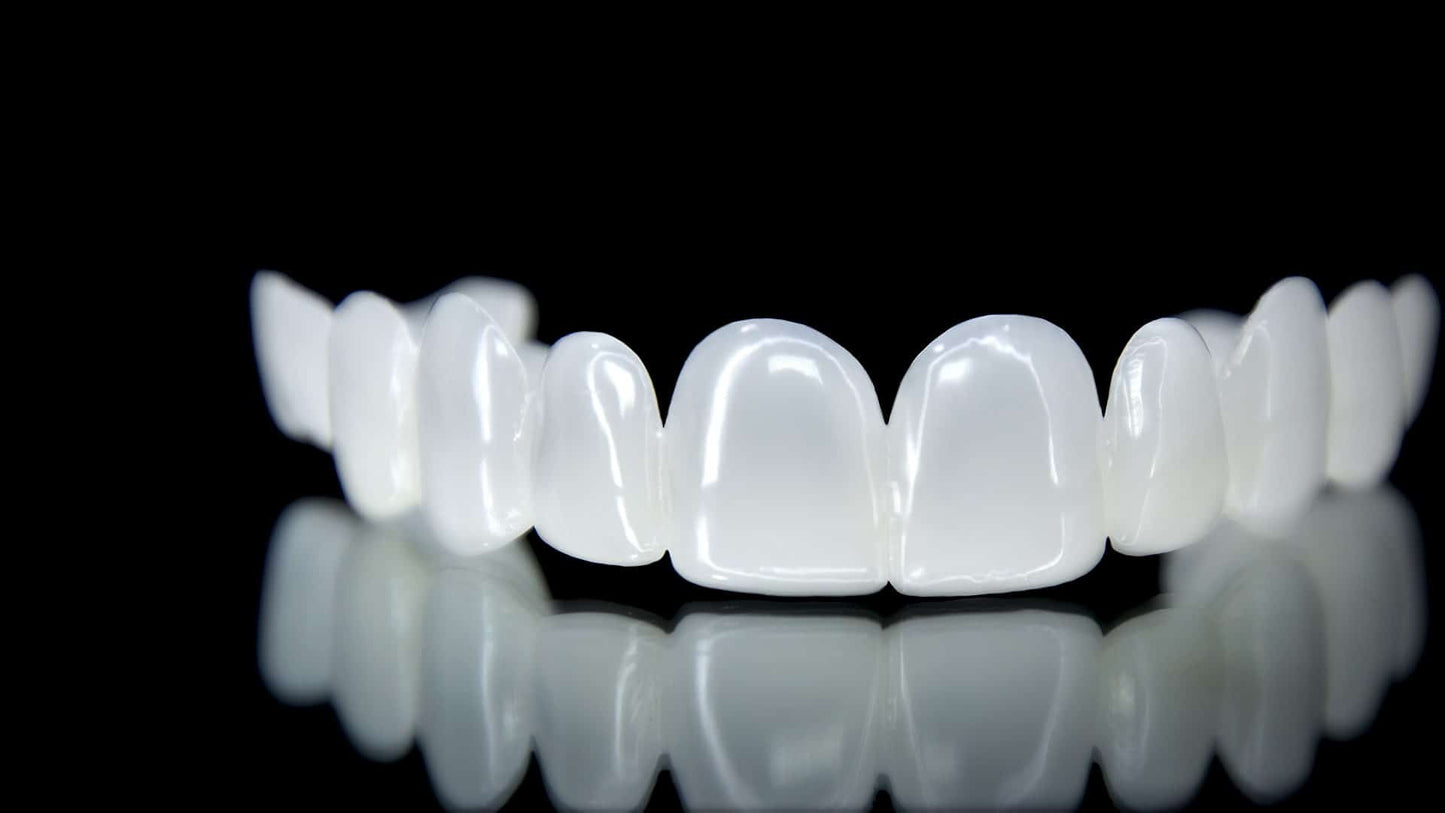 High-Precision 3D Printed Snap-On Teeth Veneers