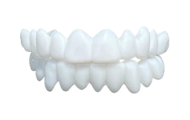 High-Precision 3D Printed Snap-On Teeth Veneers