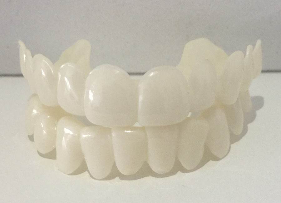 High-Precision 3D Printed Snap-On Teeth Veneers
