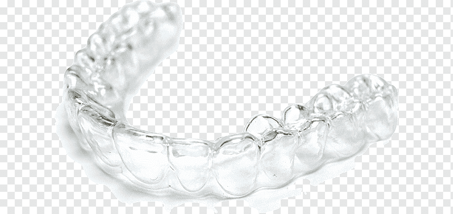 High-Precision 3D Printed Tooth Alignment Orthodontics