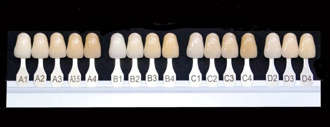 High-Precision 3D Printed Permanent Dentures