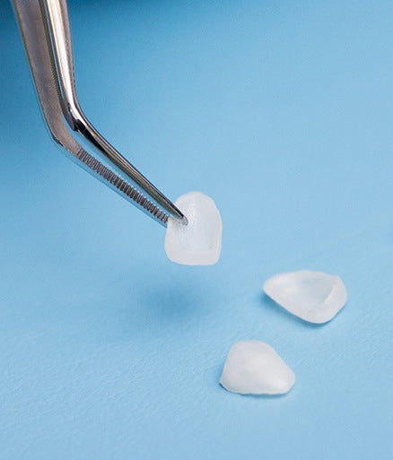 High-Precision 3D Printed Dental Veneers