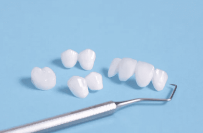 High-Precision 3D Printed Dental Veneers