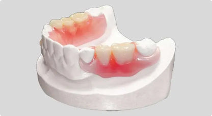 High-Precision 3D Printed Flexible Partial Dentures