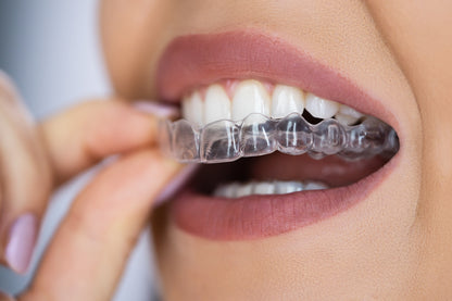 High-Precision 3D Printed Tooth Alignment Orthodontics