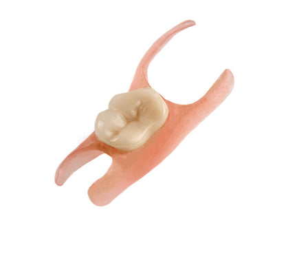 High-Precision 3D Printed Flexible Partial Dentures
